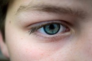 Eye